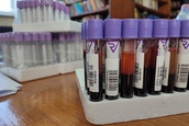 NOVA AKCIJA dobrovoljnog davanja krvi u Apatinu zakazana za 26. april