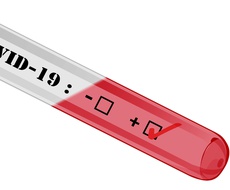 Antigen i PCR testovi samo u ZZJZ Sombor