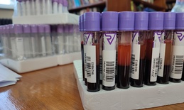 Nova akcija dobrovoljnog davanja krvi u Apatinu zakazana za 17. april