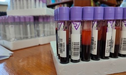 Nova akcija dobrovoljnog davanja krvi u Apatinu zakazana za 18. mart