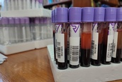 Nova akcija dobrovoljnog davanja krvi u Apatinu zakazana za 29. maj