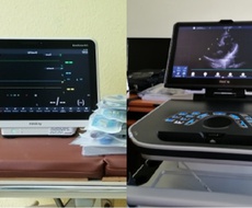 NOVA OPREMA Кoronarnoj jedinici i Odeljenju za prijem Opšte bolnice Sombor