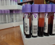 Nova AKCIJA dobrovoljnog davanja krvi u Apatinu zakazana za 27. jun