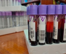 Nova akcija dobrovoljnog davanja krvi u Apatinu zakazana za 28. oktobar