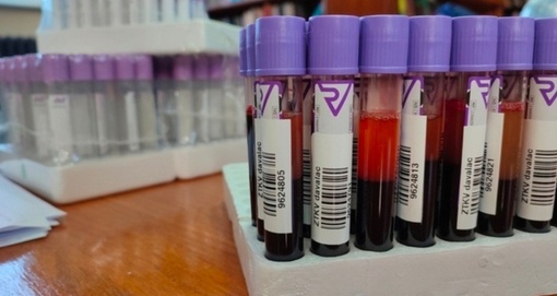 Nova akcija dobrovoljnog davanja krvi u Apatinu zakazana za 28. oktobar