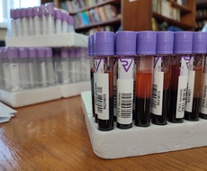 Smanjene zalihe krvi! Sutra u Apatinu VANREDNA AKCIJA dobrovoljnog davanja ove dragocene tečnosti